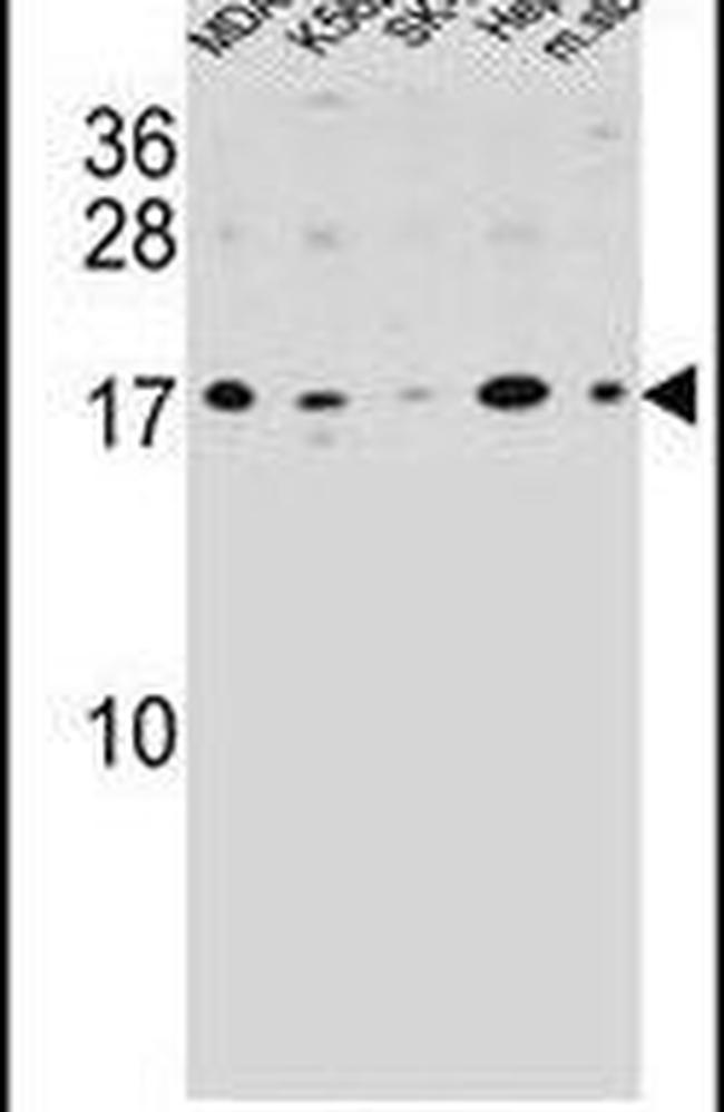 S100Z Antibody in Western Blot (WB)