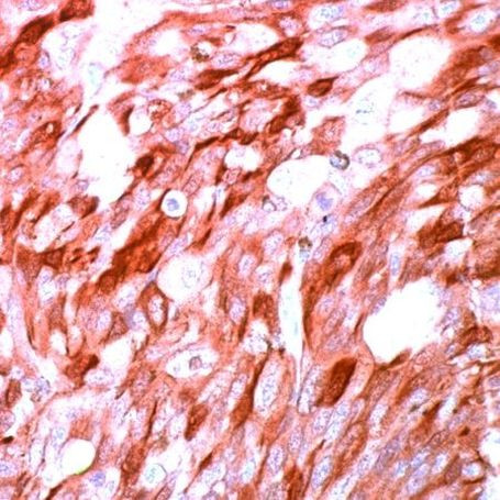 S100A1 Antibody in Immunohistochemistry (IHC)