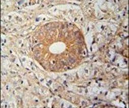SLC35E2 Antibody in Immunohistochemistry (IHC)