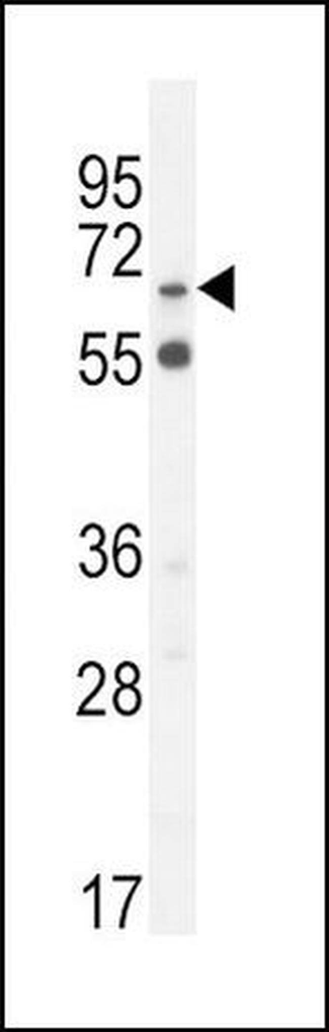 SLC6A12 Antibody in Western Blot (WB)