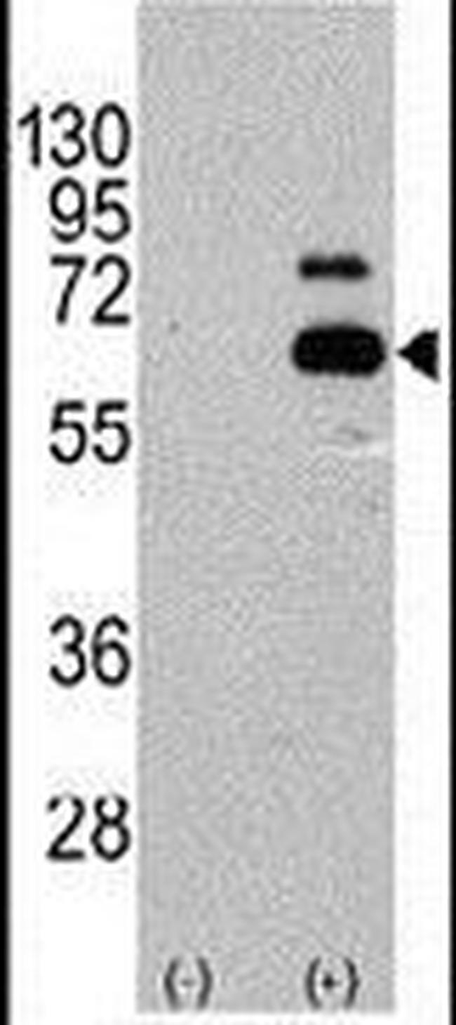 p70 S6 Kinase Antibody in Western Blot (WB)