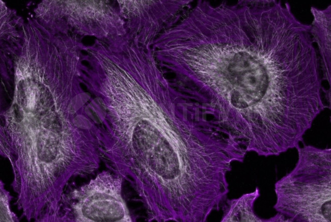 Mouse, IgG (H+L), (Subclasses 1+2a+2b+3), Fcy Fragment Specific SRM Secondary Antibody in Immunocytochemistry (ICC/IF)