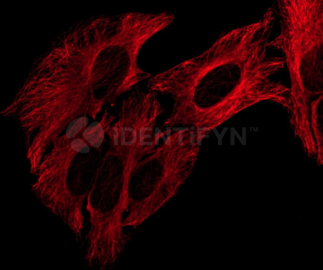 Human IgG, (H+L) SRM Secondary Antibody in Immunocytochemistry (ICC/IF)