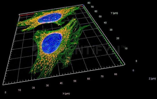 Mouse, IgG (H+L), (Subclasses 1+2a+2b+3), Fcy Fragment Specific SRM Secondary Antibody in Immunocytochemistry (ICC/IF)