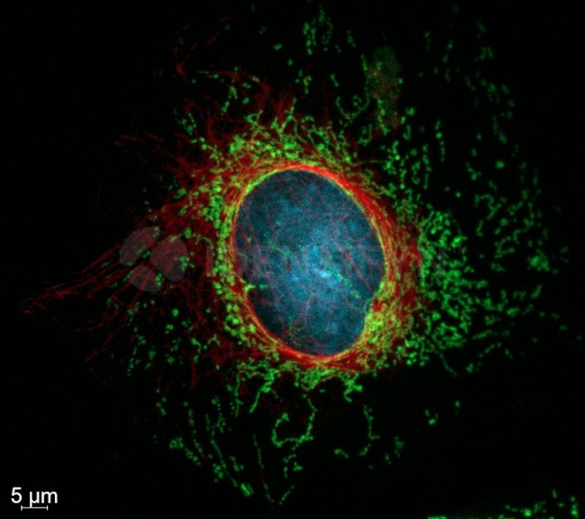 Rabbit IgG, (H+L) SRM Secondary Antibody in Immunocytochemistry (ICC/IF)