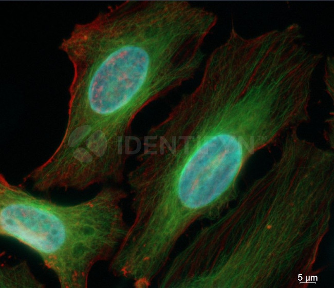 Mouse, IgG (H+L) SRM Secondary Antibody in Immunocytochemistry (ICC/IF)
