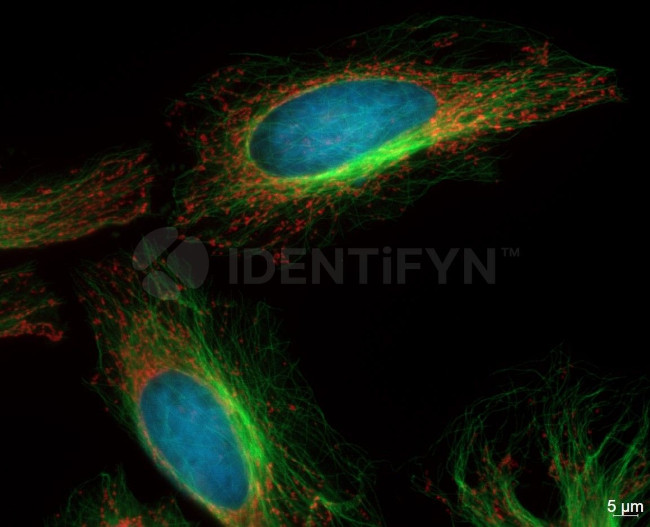Mouse IgG, (H+L) SRM Secondary Antibody in Immunocytochemistry (ICC/IF)
