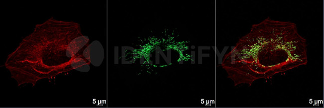 Mouse IgG, (H+L) SRM Secondary Antibody in Immunocytochemistry (ICC/IF)