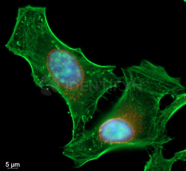 Rabbit IgG, (H+L) SRM Secondary Antibody in Immunocytochemistry (ICC/IF)