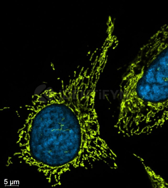 Mouse, IgG (H+L), (Subclasses 1+2a+2b+3), Fcy Fragment Specific SRM Secondary Antibody in Immunocytochemistry (ICC/IF)