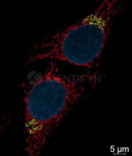Rabbit IgG, (H+L) SRM Secondary Antibody in Immunocytochemistry (ICC/IF)