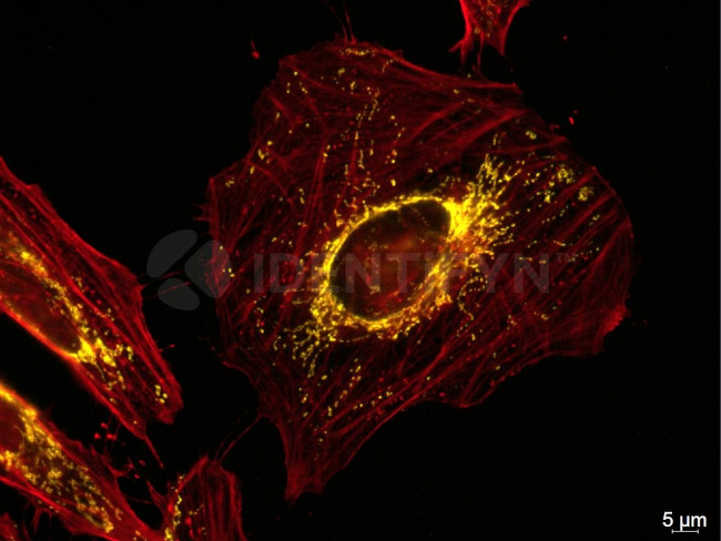 Mouse IgG, (H+L) SRM Secondary Antibody in Immunocytochemistry (ICC/IF)