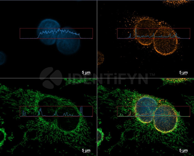 Mouse, IgG (H+L), (Subclasses 1+2a+2b+3), Fcy Fragment Specific SRM Secondary Antibody in Immunocytochemistry (ICC/IF)