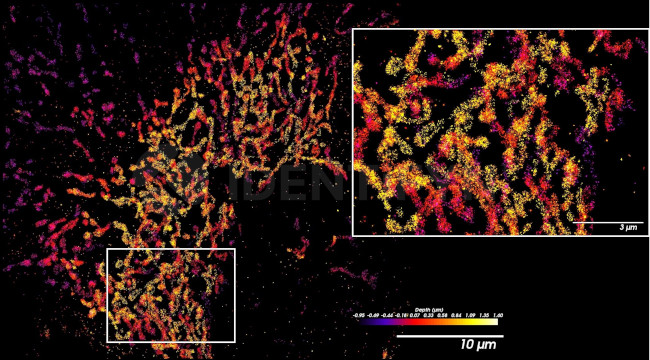 Rabbit IgG, (H+L) SRM Secondary Antibody in Immunocytochemistry (ICC/IF)