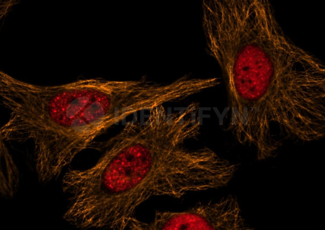 Mouse, IgG (H+L) SRM Secondary Antibody in Immunocytochemistry (ICC/IF)