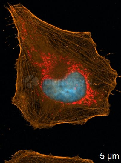 Rabbit IgG, (H+L) SRM Secondary Antibody in Immunocytochemistry (ICC/IF)