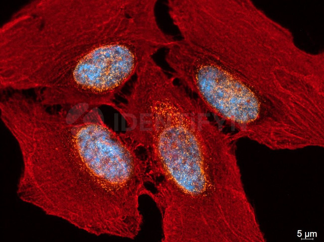 Mouse IgG, (H+L) SRM Secondary Antibody in Immunocytochemistry (ICC/IF)