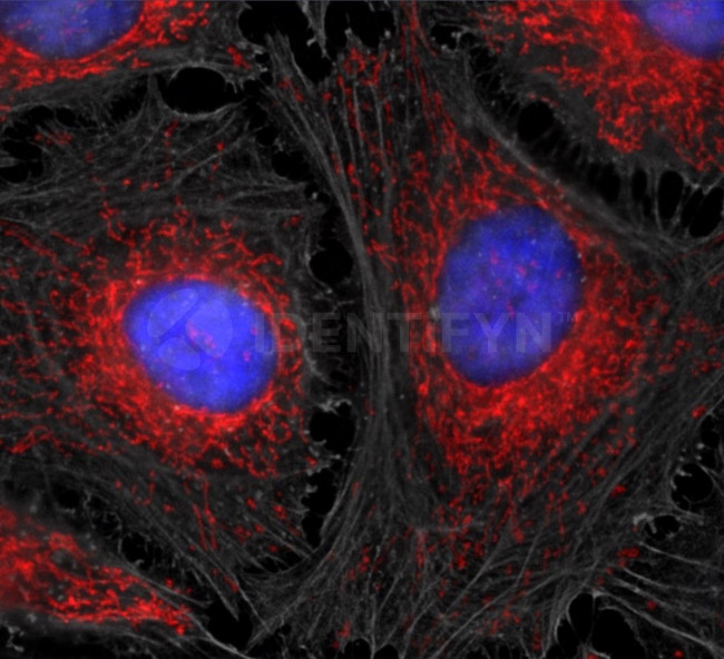 Mouse, IgG (H+L), (Subclasses 1+2a+2b+3), Fcy Fragment Specific SRM Secondary Antibody in Immunocytochemistry (ICC/IF)