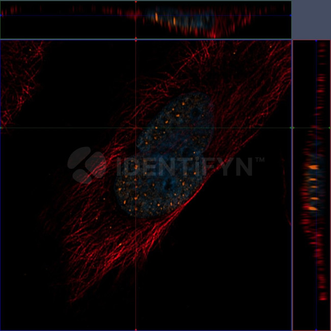 Human, IgG (H+L) SRM Secondary Antibody in Immunocytochemistry (ICC/IF)