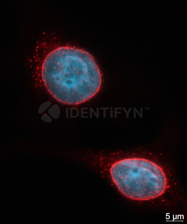 Mouse IgG, (H+L) SRM Secondary Antibody in Immunocytochemistry (ICC/IF)