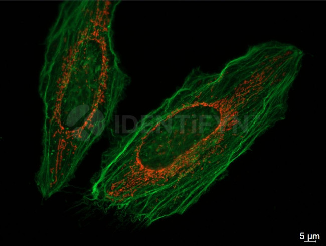 Mouse IgG, (H+L) SRM Secondary Antibody in Immunocytochemistry (ICC/IF)