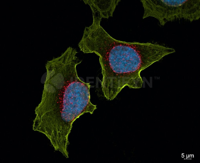 Mouse, IgG (H+L), (Subclasses 1+2a+2b+3), Fcy Fragment Specific SRM Secondary Antibody in Immunocytochemistry (ICC/IF)