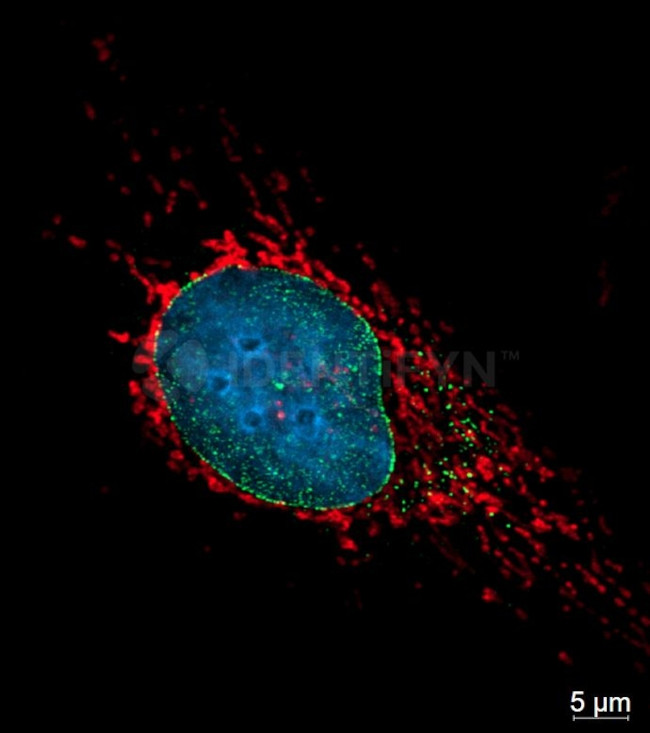 Rabbit IgG, (H+L) SRM Secondary Antibody in Immunocytochemistry (ICC/IF)