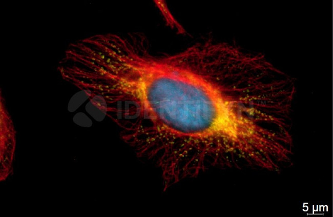 Mouse, IgG (H+L), (Subclasses 1+2a+2b+3), Fcy Fragment Specific SRM Secondary Antibody in Immunocytochemistry (ICC/IF)