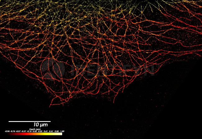 Rat IgG, (H+L) SRM Secondary Antibody in Immunocytochemistry (ICC/IF)