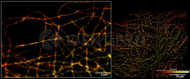 Rat IgG, (H+L) SRM Secondary Antibody in Immunocytochemistry (ICC/IF)