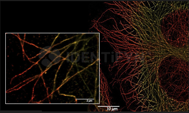Rat IgG, (H+L) SRM Secondary Antibody in Immunocytochemistry (ICC/IF)