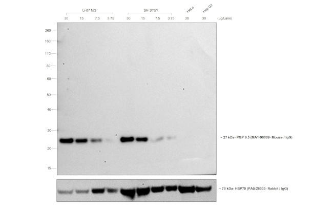 Mouse IgG (H+L) Cross-Adsorbed Secondary Antibody in Western Blot (WB)