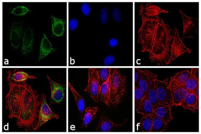 Mouse IgG Fab Secondary Antibody in Immunocytochemistry (ICC/IF)