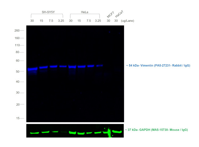 Rabbit IgG (H+L) Cross-Adsorbed Secondary Antibody in Western Blot (WB)