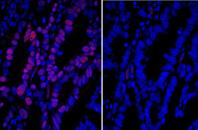 Goat IgG (H+L) Cross-Adsorbed Secondary Antibody in Immunohistochemistry (Paraffin) (IHC (P))