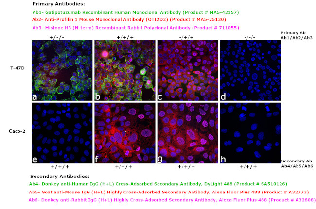 Human IgG (H+L) Cross-Adsorbed Secondary Antibody in Immunocytochemistry (ICC/IF)