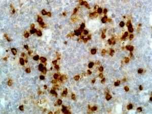 Human Lambda Light Chain Secondary Antibody in Immunohistochemistry (IHC)