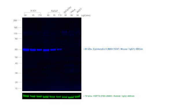 Mouse IgG1 Secondary Antibody in Western Blot (WB)