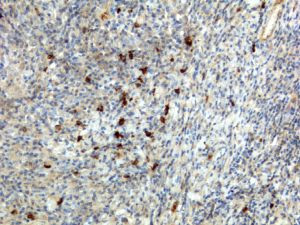 Human IgA1/IgA2 Secondary Antibody in Immunohistochemistry (IHC)