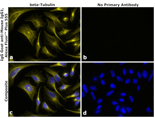 Mouse IgG1 Secondary Antibody in Immunocytochemistry (ICC/IF)