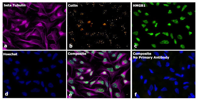 Mouse IgG1 Secondary Antibody in Immunocytochemistry (ICC/IF)