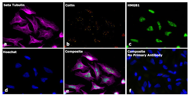 Mouse IgG1 Secondary Antibody in Immunocytochemistry (ICC/IF)