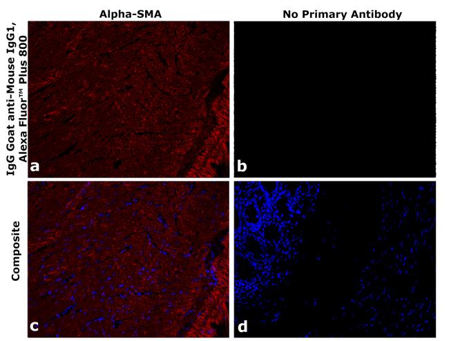 Mouse IgG1 Secondary Antibody in Immunohistochemistry (Paraffin) (IHC (P))