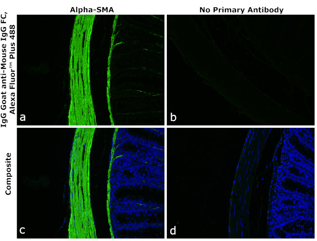 Mouse IgG Fc Secondary Antibody in Immunohistochemistry (Paraffin) (IHC (P))
