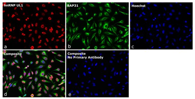 Rat IgG2b Secondary Antibody in Immunocytochemistry (ICC/IF)