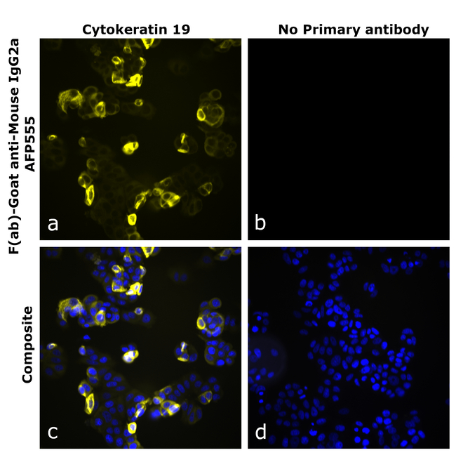 Mouse IgG2a Secondary Antibody in Immunocytochemistry (ICC/IF)