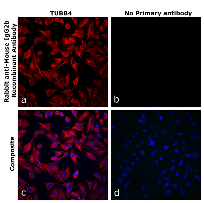 Mouse IgG2b Secondary Antibody in Immunocytochemistry (ICC/IF)