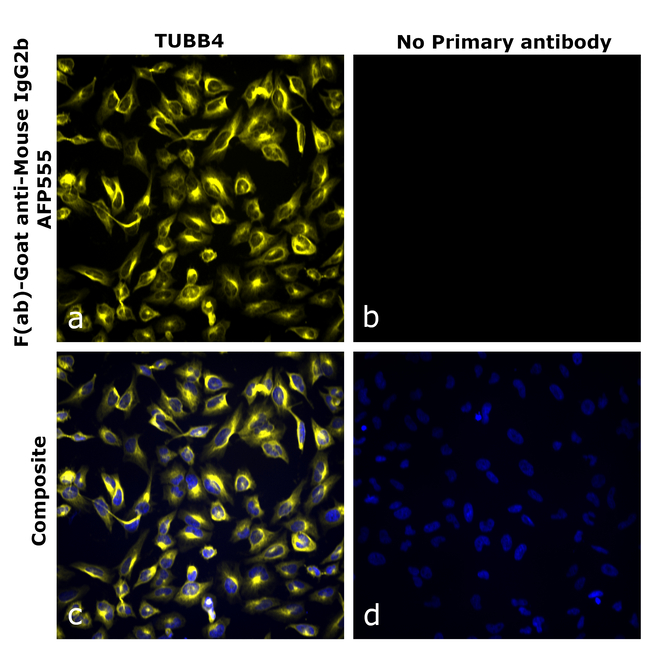 Mouse IgG2b Secondary Antibody in Immunocytochemistry (ICC/IF)