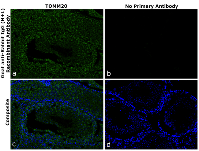 Rabbit IgG (H+L) Secondary Antibody in Immunohistochemistry (Paraffin) (IHC (P))