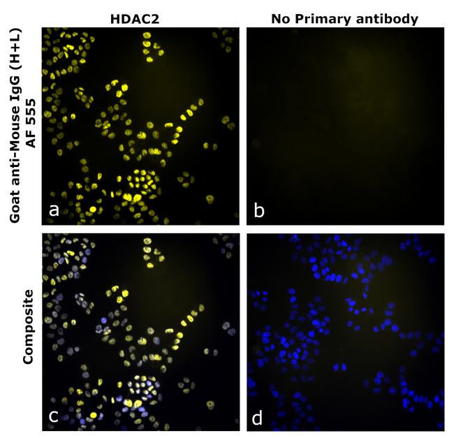 Mouse IgG (H+L) Secondary Antibody in Immunocytochemistry (ICC/IF)